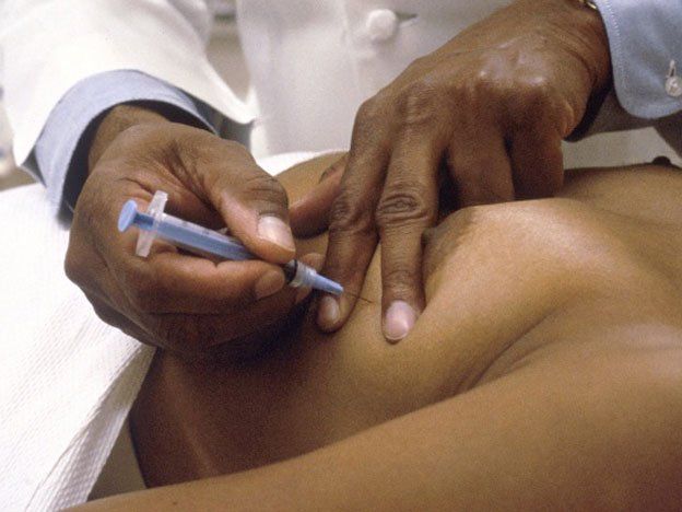 Prueban nuevo tratamiento contra el cáncer de mama