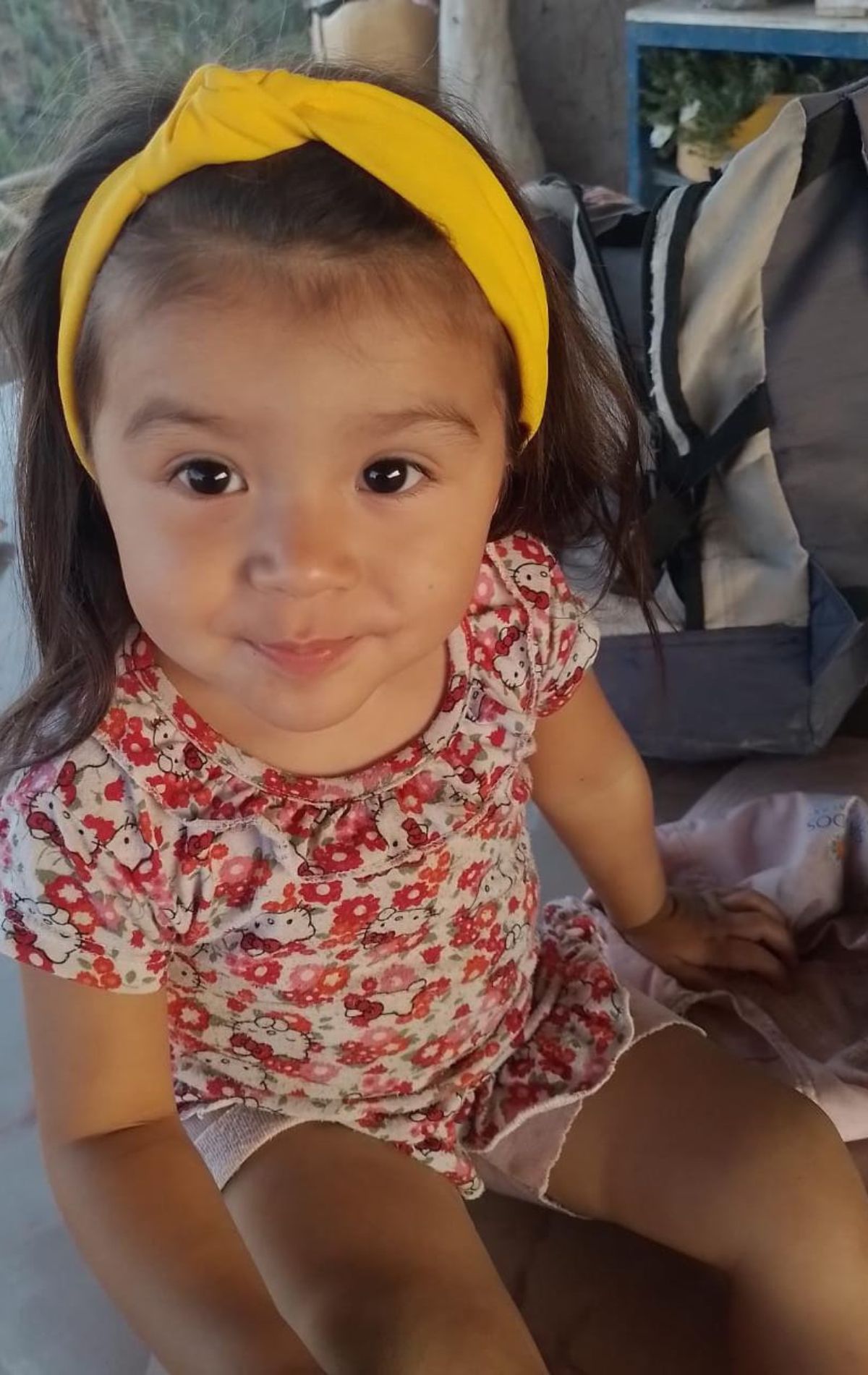 Emilia tiene dos años, nació con el síndrome de Klippel-Trenaunay-Weber y su salud y vida corre peligro, por lo que necesita operarse urgente.