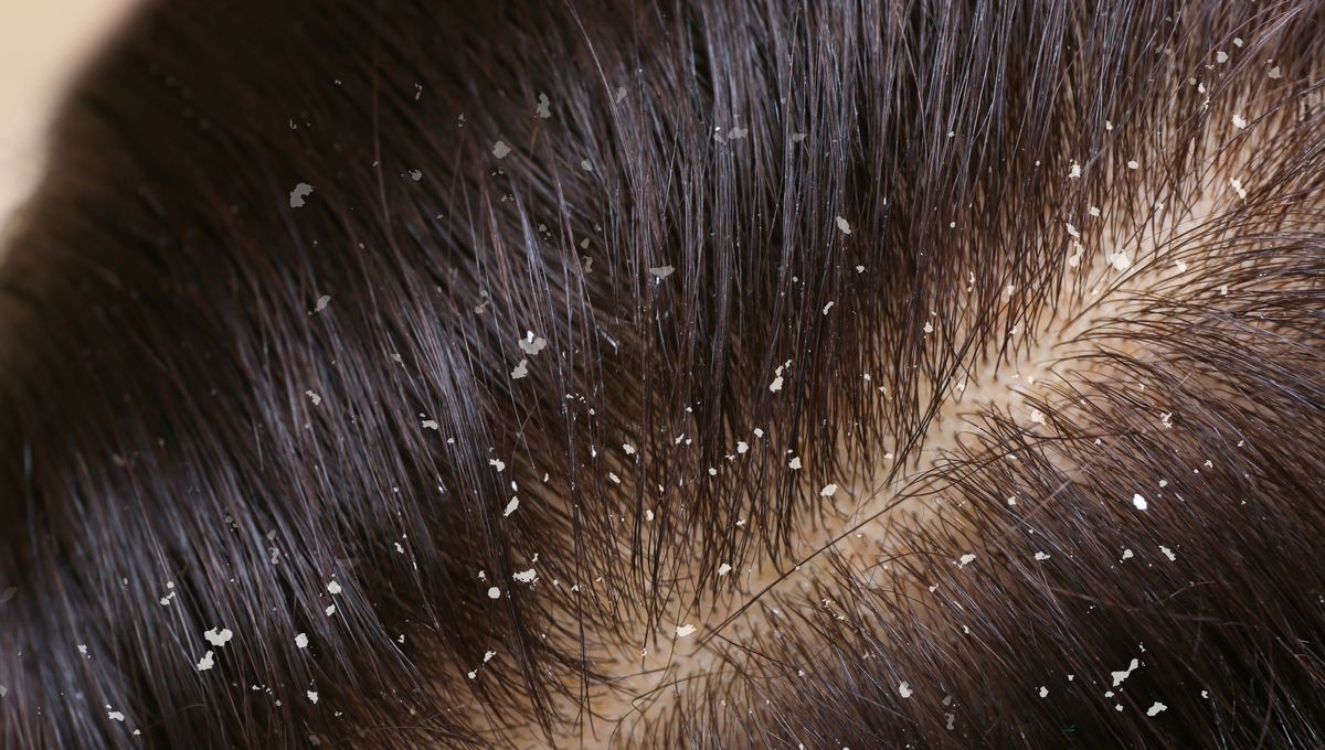 El vinagre de manzana es un producto con grandes propiedades para la piel y el cabello. El vinagre de manzana es un producto con grandes propiedades para la piel y el cabello. 