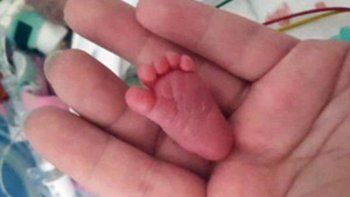 Cumplió 9 meses la bebé más pequeña del mundo