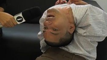 El curioso caso del hombre que nació con la cabeza al revés