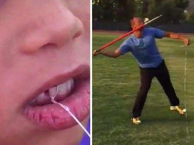 Impresionante: utilizó la jabalina para sacarle el diente a su hija