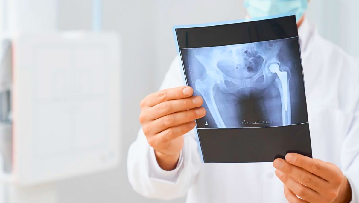 Traumatólogos suspendieron la atención en las cinco clínicas que los denunciaron ante la Nación. Traumatólogos suspendieron la atención en las cinco clínicas que los denunciaron ante la Nación.