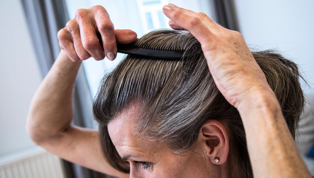 Las canas pueden ser eliminadas a través del uso de la manzanilla y la cúrcuma.