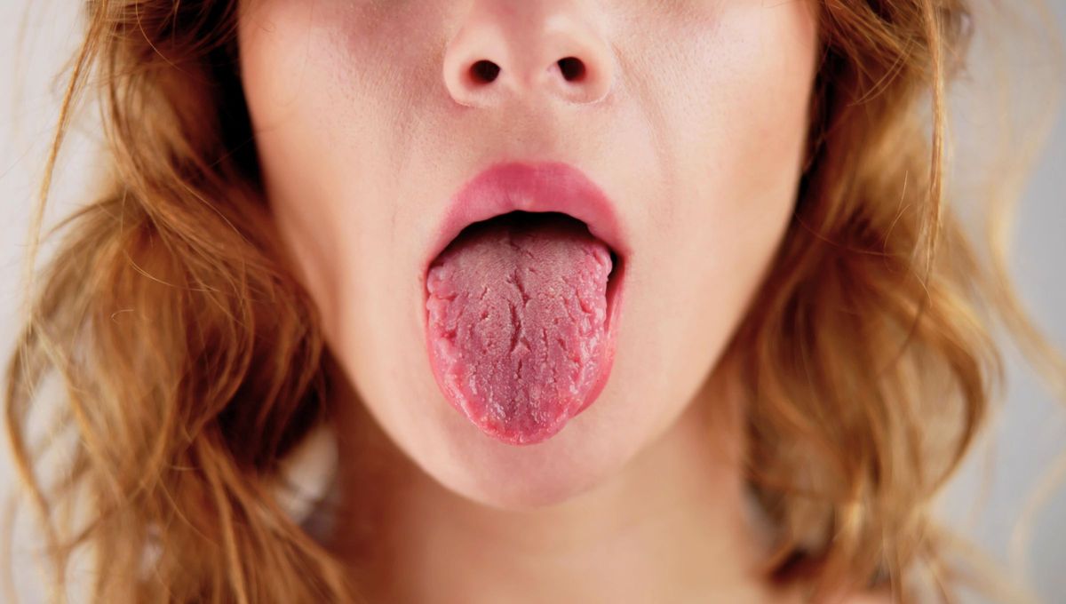 Revela mucho sobre tu salud: qué significa tener la lengua con grietas