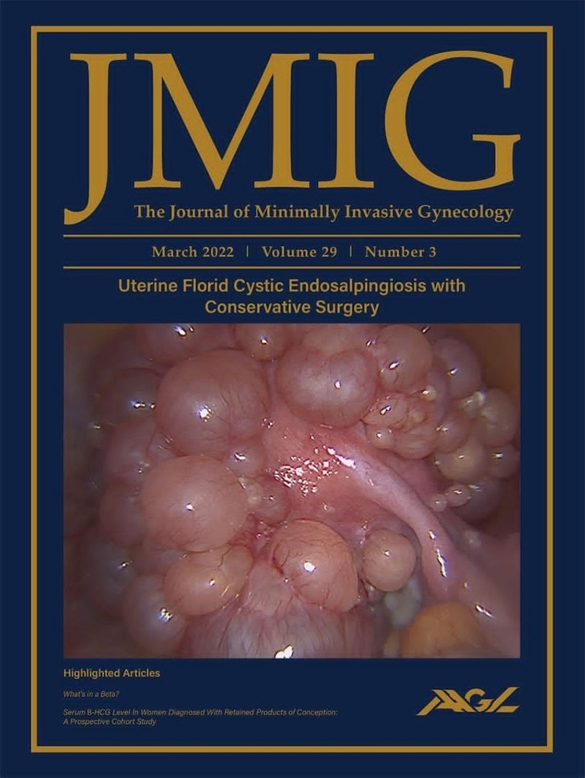Nota de tapa marzo 2022 en Journal of Minimally Invasive Gynecology.