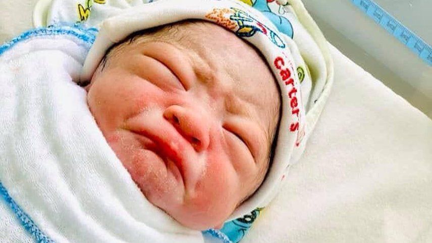 La Impactante Imagen De Un Bebé Que Nació Con Un Diu En La Mano 9730