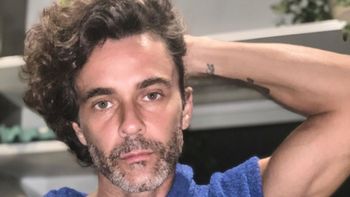 La cruda historia de Mariano Martínez: lo atropelló un micro y casi pierde una pierna