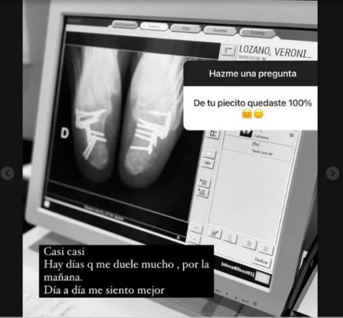 Impresión. Verónica Lozano mostró una impactante foto de sus pies tras caerse de la aerosilla.