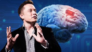 Elon Musk le implantó un chip en el cerebro a un hombre y un año después revela lo impensado