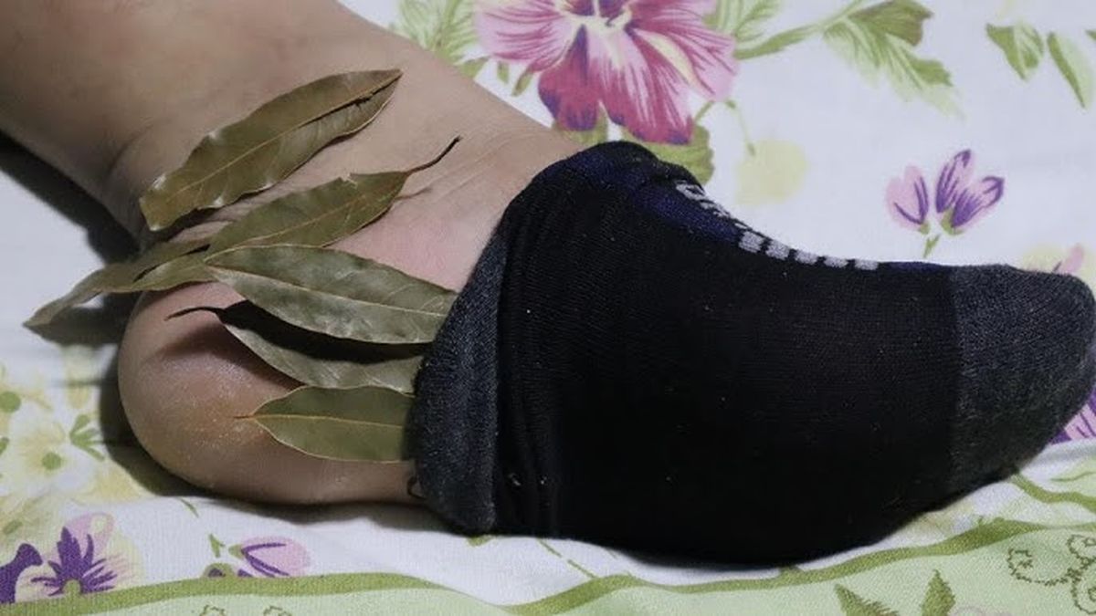Las hojas de laurel pueden ser realmente efectivas para tus pies.&nbsp;