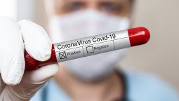 Covid: cómo saber si ya tuviste el virus