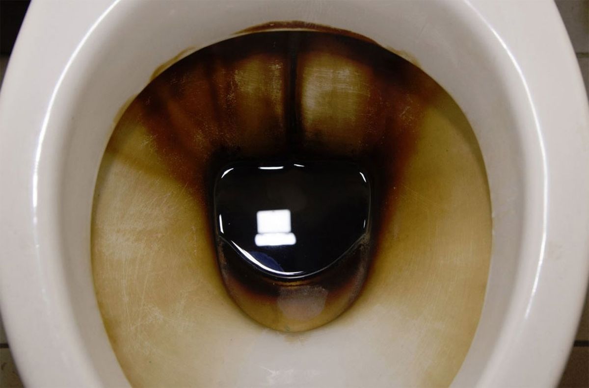 El inodoro del ba&ntilde;o puede acumular una cantidad impensada de sarro, si no se aplica un m&eacute;todo para limpiar con profundidad.