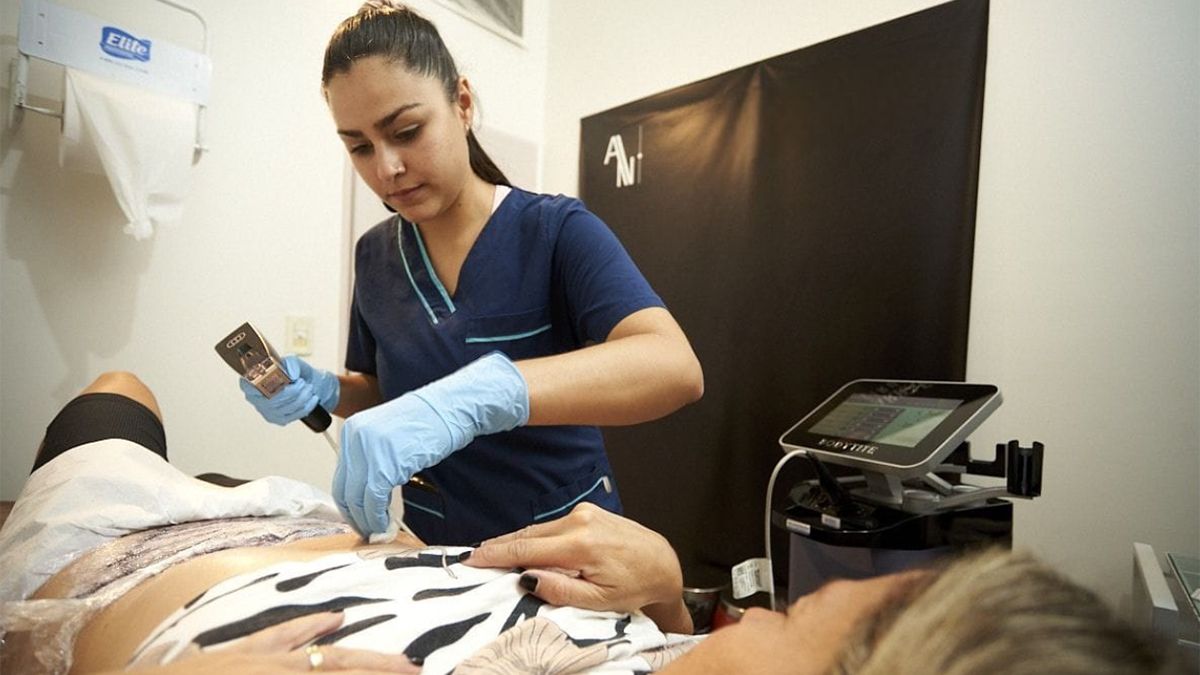 Los resultados del tratamiento Morpheus 8 se obtienen en dos o tres sesiones. cada una tiene un valor de 350.000 pesos argentinos. Los resultados del tratamiento Morpheus 8 se obtienen en dos o tres sesiones. cada una tiene un valor de 350.000 pesos argentinos.