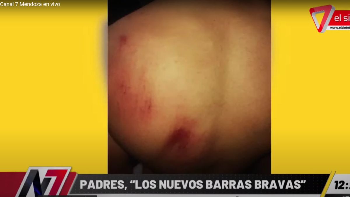 Además de la pérdida de memoria y evidentes golpes en la cabeza y rotura de una pieza dental, el jugador de las inferiores de Murialdo presentó escoriaciones en la piel en varias partes del cuerpo.