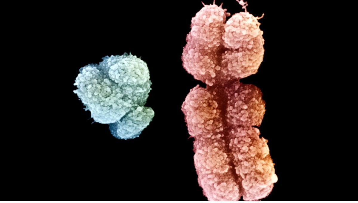  Cromosoma X y un cromosoma Y. Un gen asociado a la altura, denominado SHOX Cromosoma X y un cromosoma Y. Un gen asociado a la altura, denominado SHOX