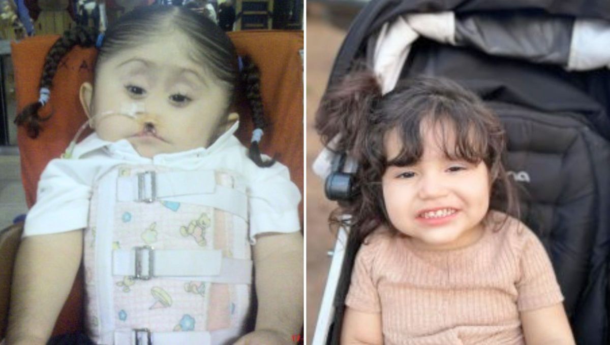 La imposibilidad del desarrollo del tejido primordial puede causar complicaciones que van desde dificultades de aprendizaje, malformaciones hasta convulsiones La imposibilidad del desarrollo del tejido primordial puede causar complicaciones que van desde dificultades de aprendizaje, malformaciones hasta convulsiones