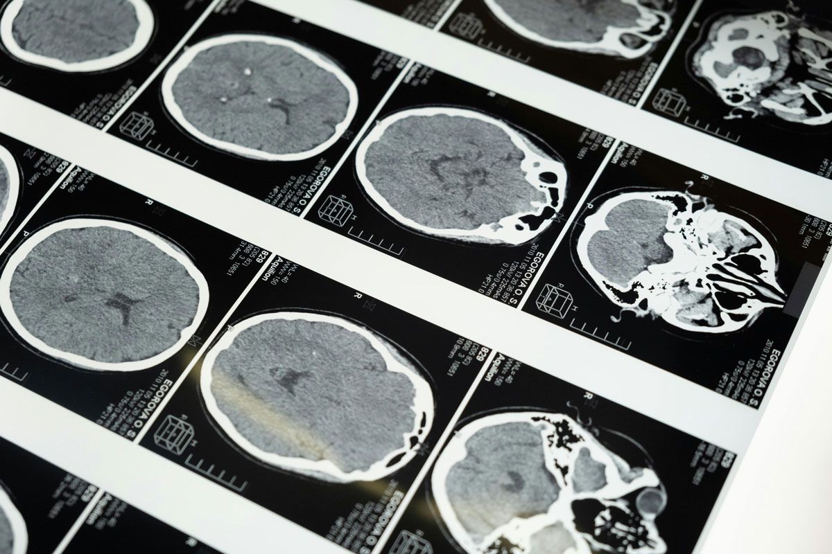 Investigaciones recientes muestran que una variedad de h&aacute;bitos intelectuales puede actuar como un verdadero entrenamiento para el cerebro, fortaleciendo conexiones neuronales y ayudando a mantener la mente activa con el paso del tiempo.