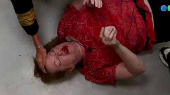 ¿Sangre o pintura?: escándalo por las fotos del golpe de Andrea del Boca en Gran Hermano ¿Sangre o pintura?: escándalo por las fotos del golpe de Andrea del Boca en Gran Hermano