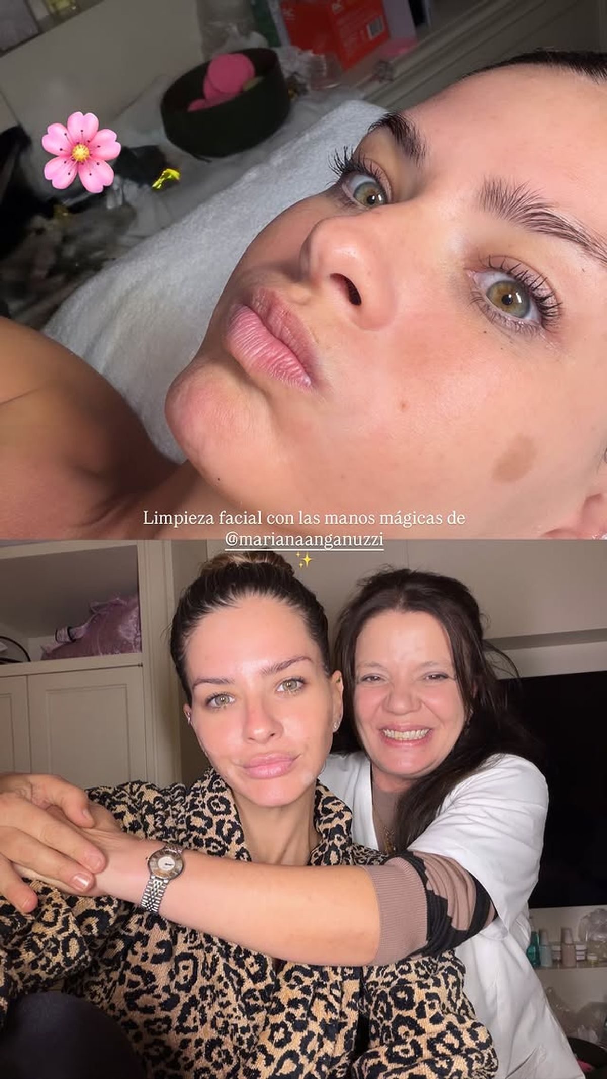 La China Suárez mostró cómo quedó tras su limpieza facial. La China Suárez mostró cómo quedó tras su limpieza facial.