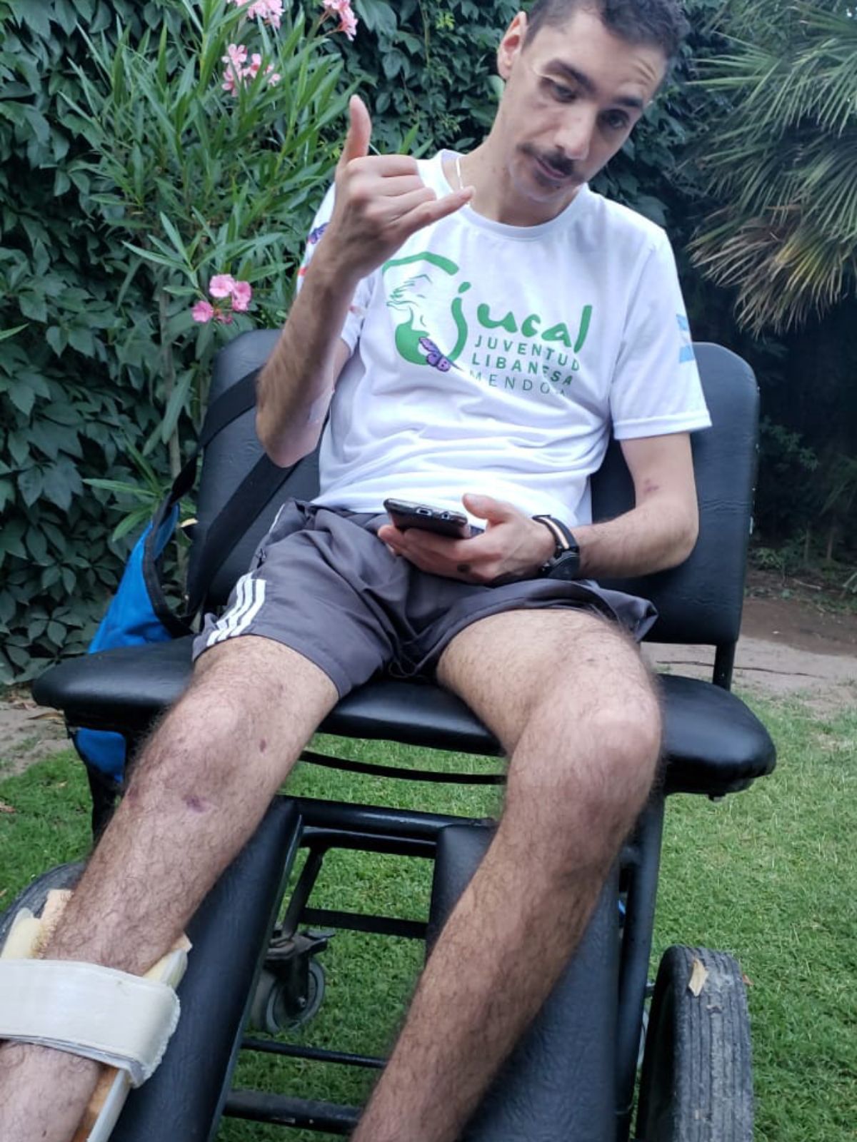 Daou convalesciente en su casa, tras una operación de su pierna. Llegó a pesar 40kg estando internado.