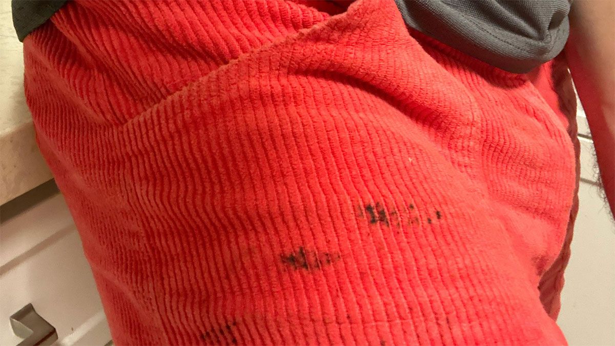 Cómo limpiar rápido las manchas de grasa de la ropa