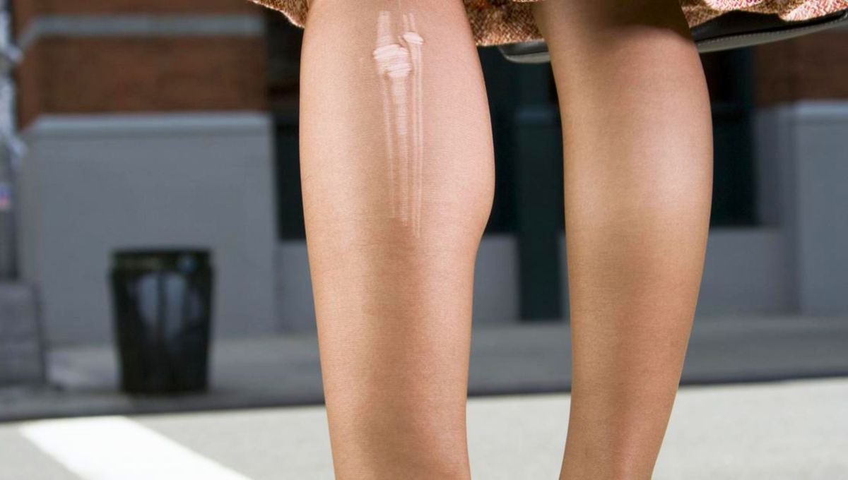 Un canc&aacute;n roto puede reciclarse y convertirse en colines.&nbsp;