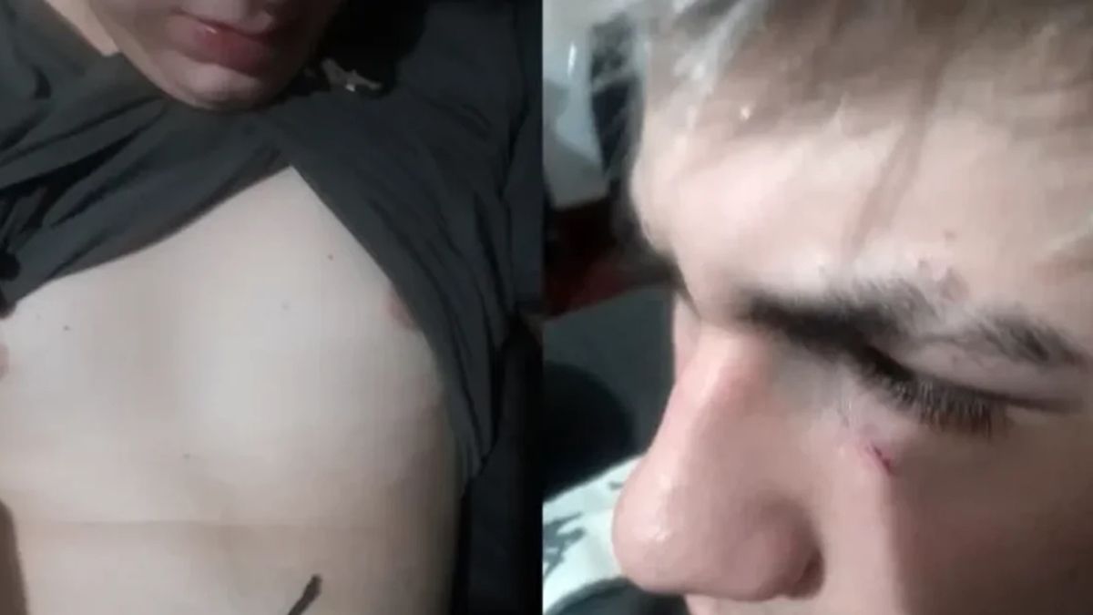 El adolescente fue atacado brutalmente por los patovicas, quienes además de causarle lesiones, robaron sus pertenencias El adolescente fue atacado brutalmente por los patovicas, quienes además de causarle lesiones, robaron sus pertenencias