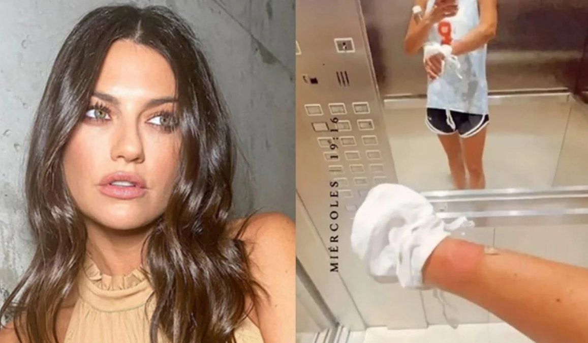 Sofía Jujuy Jiménez incorporó el boxeo a su rutina deportiva, y por pegarle con tanta fuerza a la bolsa se accidentó sus brazos