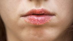 Exfoliación de labios: la rutina ideal para una piel perfecta