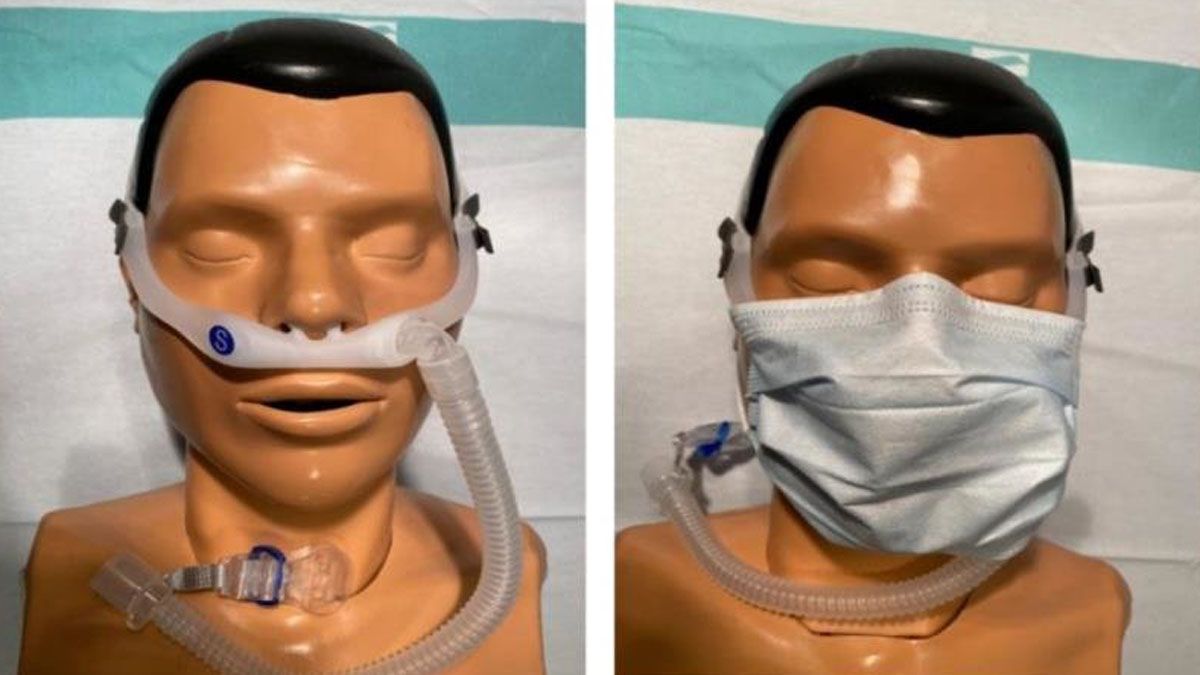 Cánula nasal de alto flujo con mascarilla quirúrgica.