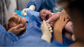 Ocho de cada 10 bebés nacen por cesárea en Mendoza: qué cambia desde julio con el nuevo sistema