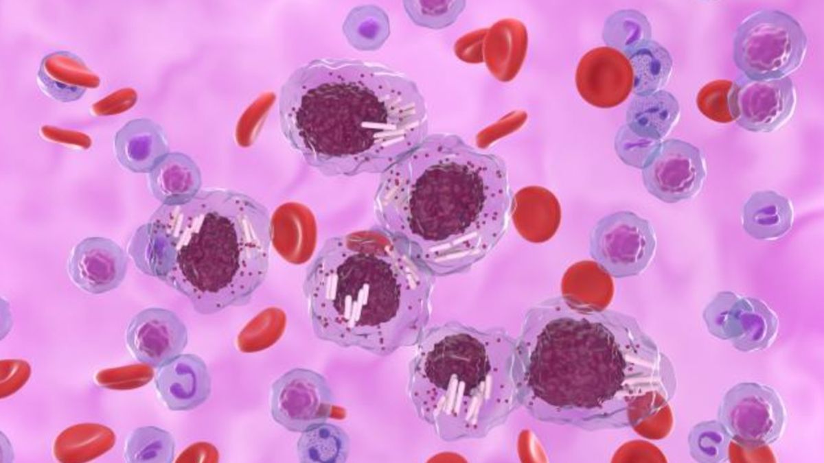 Leucemia Linfocítica Crónica: de que se trata esta enfermedad que ataca a los adultos