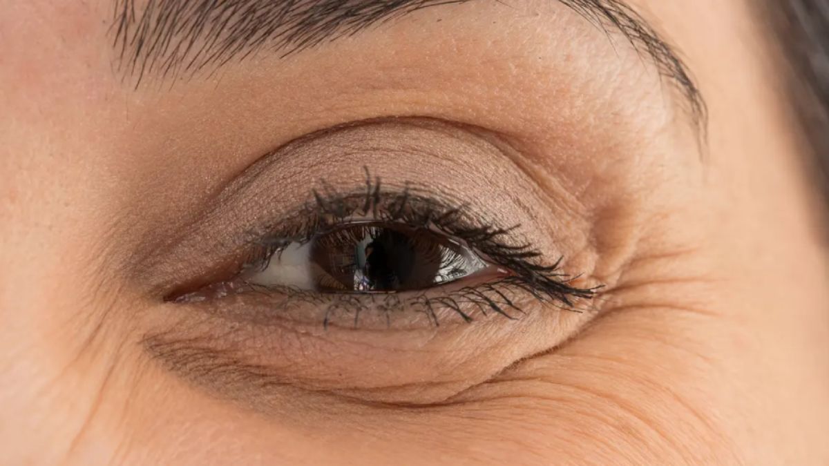 Las patas de gallo pueden disminuir notablemente con estos trucos caseros.