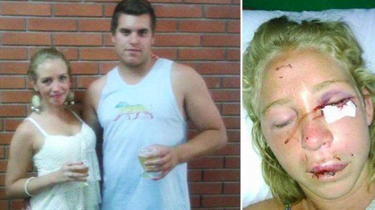 La joven que denunció a su novio por una brutal paliza dijo que había sido por bailar como una trola