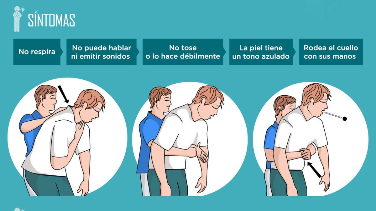 Maniobra de Heimlich. Si una persona se ahoga con esta maniobra le pod&eacute;s salvar la vida.&nbsp;