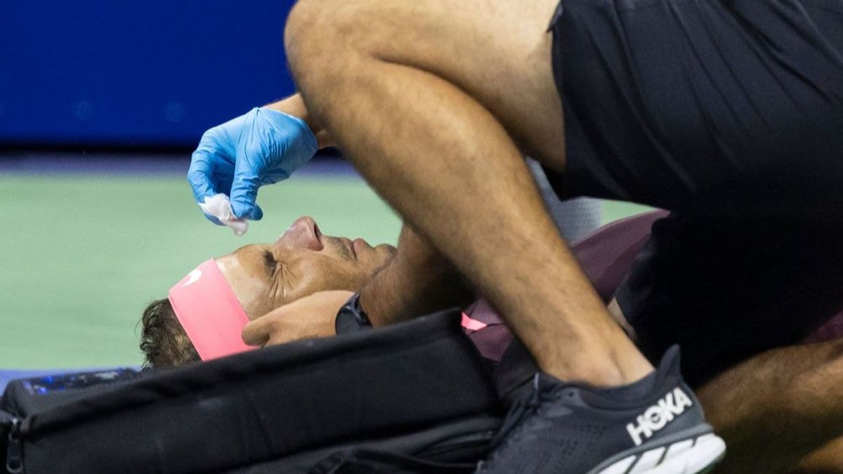 Rafael Nadal sufrió un duro golpe en la nariz.