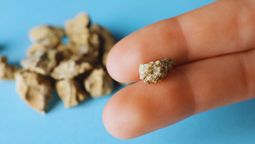 Tomaba 3 litros de Coca-Cola por día y le sacaron 35 piedras de la vejiga