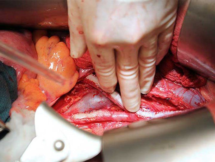 Logran generar músculos cardiacos a partir del prepucio
