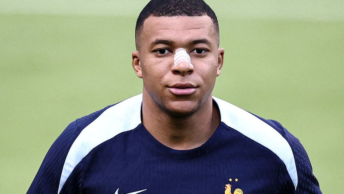 Mbappé se mostró con una cobertura en su nariz en el entrenamiento de la Selección de Francia.&nbsp;