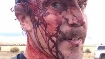 Sobrevivió al ataque de una osa y se grabó para mostrar cómo sangraban sus terribles heridas