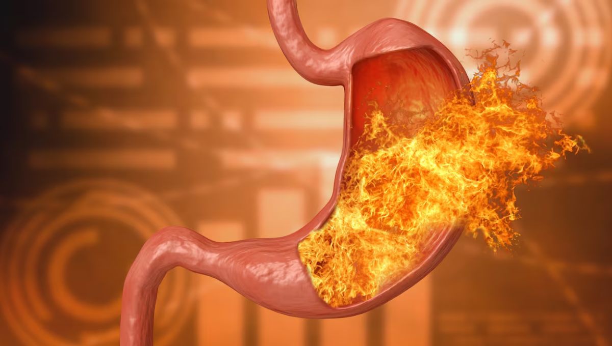 Chau acidez: el truco casero y natural que elimina el ardor estomacal en minutos