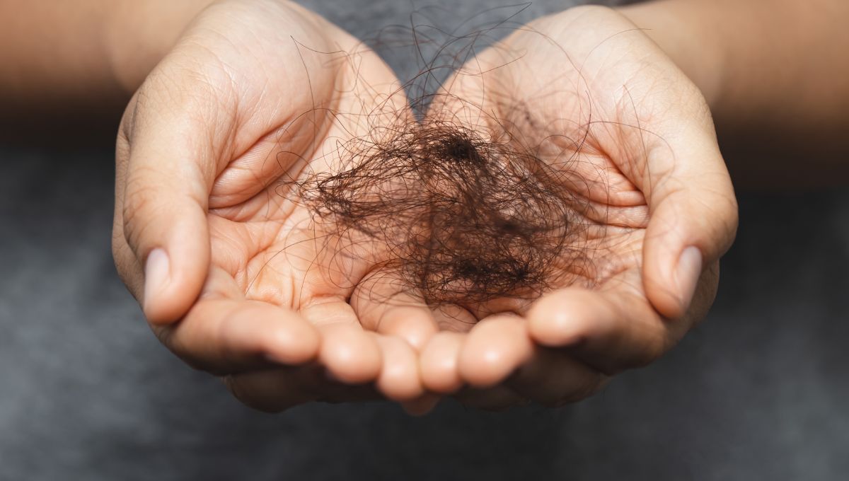 CaÍda del cabello. CaÍda del cabello. 