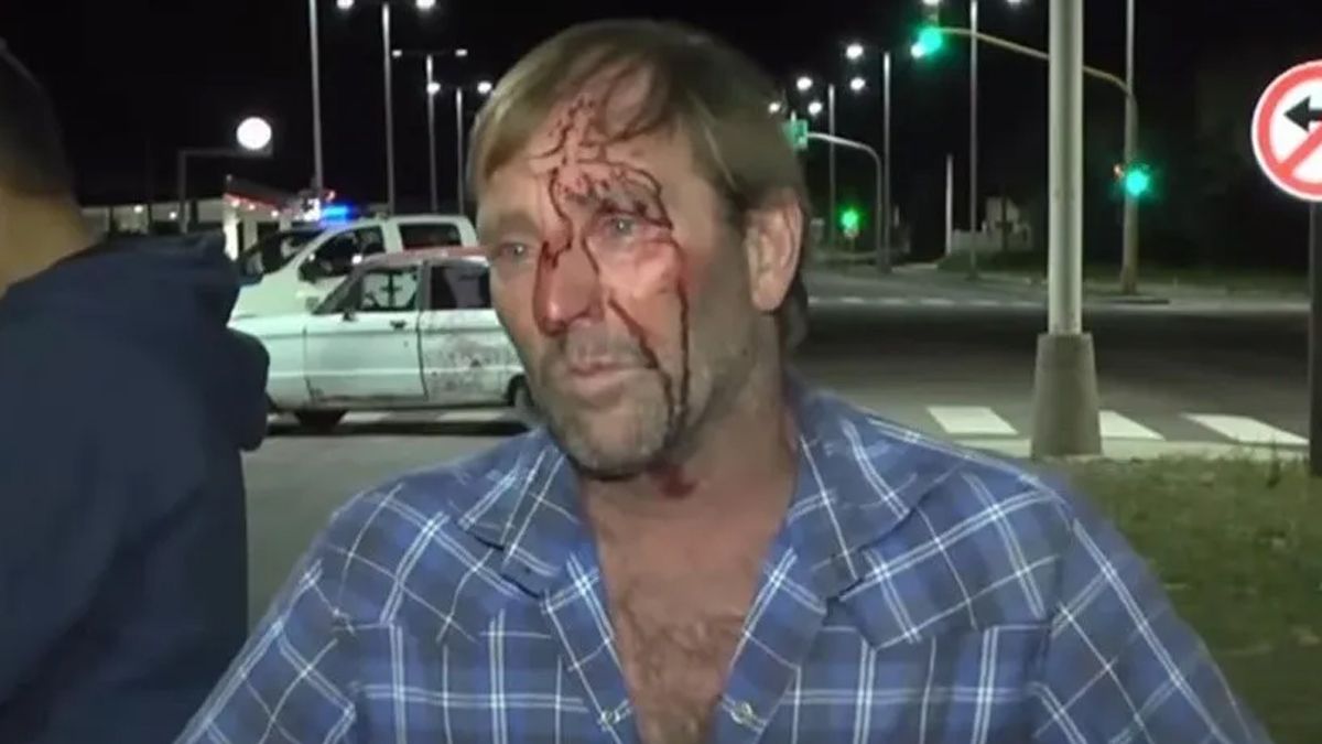 El conductor borracho habló con la prensa visiblemente ensangrentado.