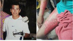 Un boxeador roció con nafta y prendió fuego a su novia Un boxeador roció con nafta y prendió fuego a su novia