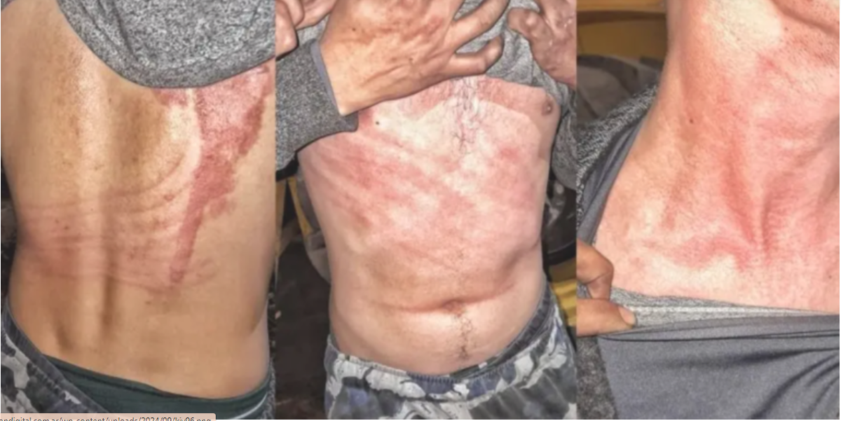 Un obrero del campo dijo que fue atacado por una "fuerza paranormal" y mostró las marcas. Un obrero del campo dijo que fue atacado por una "fuerza paranormal" y mostró las marcas.