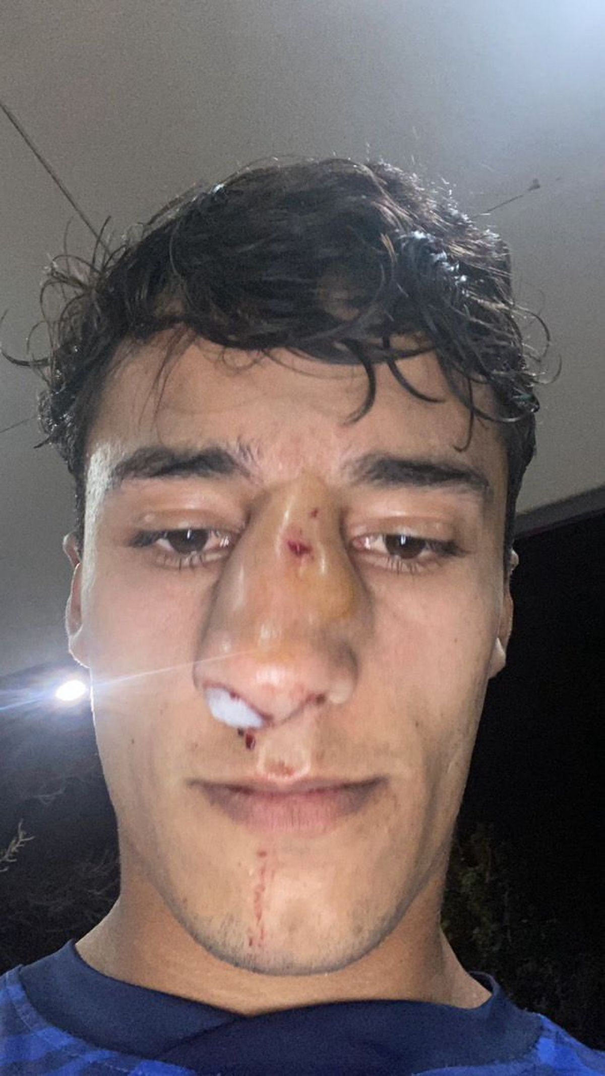 Emiliano Britos, jugador de Universidad Nacional de Cuyo fue agredido por Matías Navarro, de FADEP, en un partido de la Liga Mendocina.&nbsp;