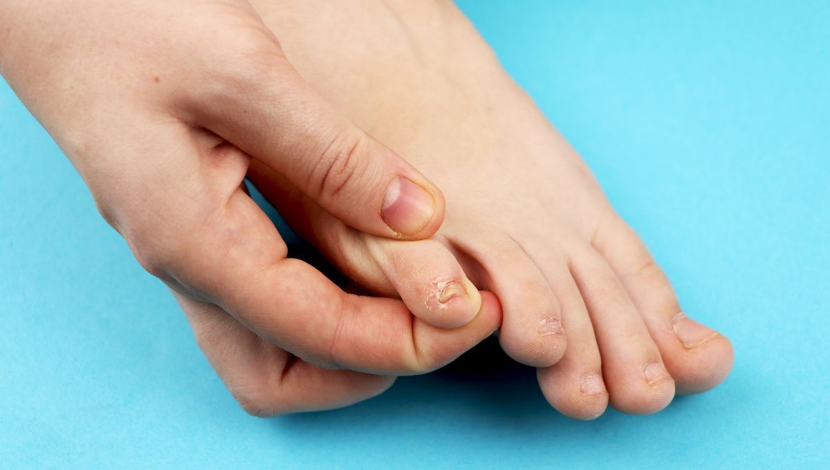 El secreto de las mujeres andinas para eliminar hongos de los pies