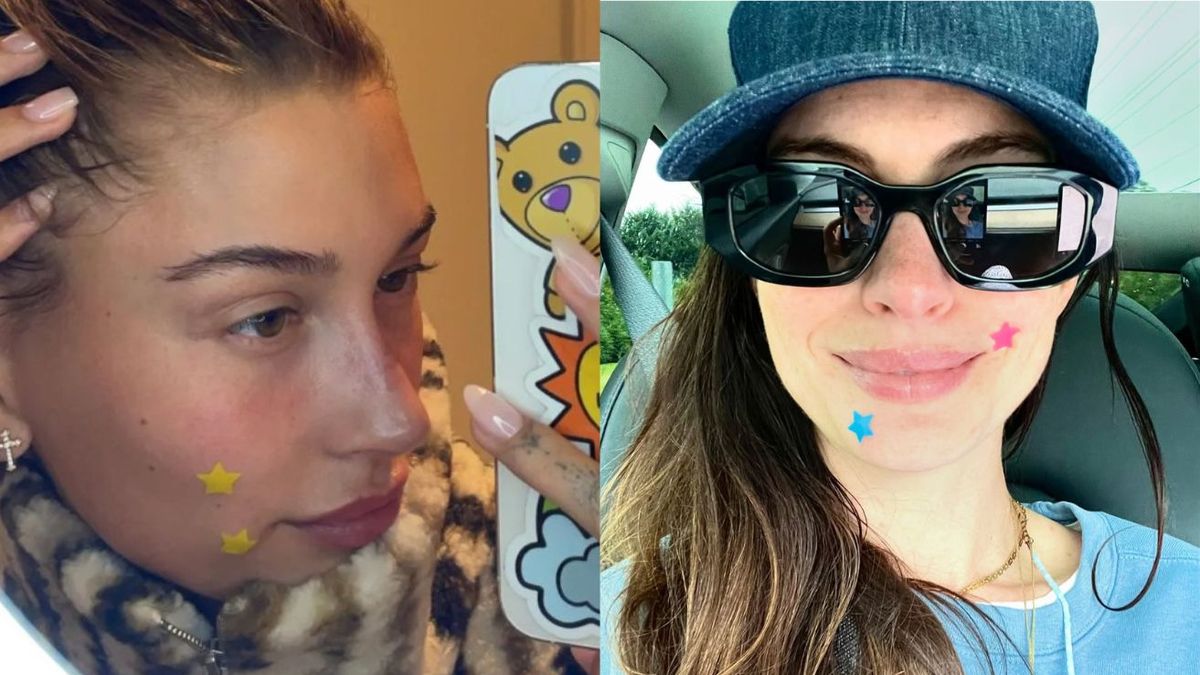 Star-Shaped Patches & TikTok's Impact - News Directory 3