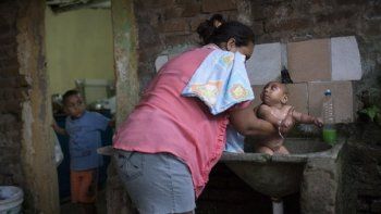 La difícil vida de José, un bebé cuya madre fue contagiada de zika